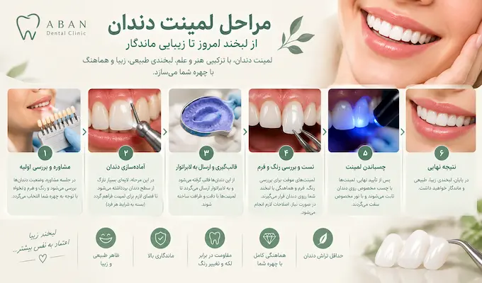 مراحل درمان لمینت